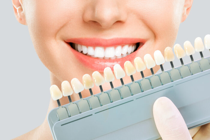 Ashley Dental Center - Cosmetic Dentist in Adelphi, MD 20783