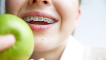 Acre Wood Dental - Orthodontist in Waco, TX 76705