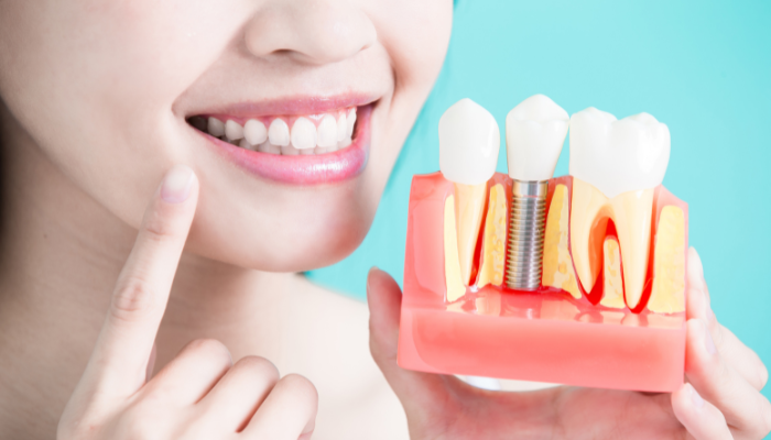 Ascent Dental - Dental Implant Specialist in Denver, CO 80246