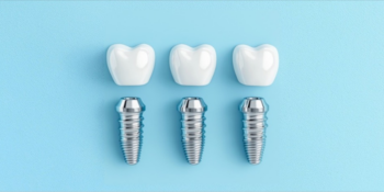 Aspen Dental - Private Practice of Cherry Creek - Dental Implant Specialist in Denver, CO 80206