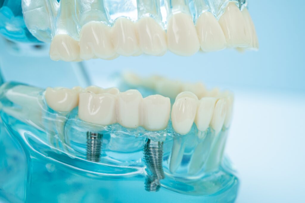 Yerba Buena Dentistry - Dental Implant Specialist in 94111