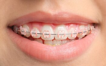 Zurcher Orthodontics - Orthodontist in Draper, UT 84020