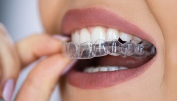 Smile City Orthodontics - Clear Aligners in Sunnyvale, TX 75182