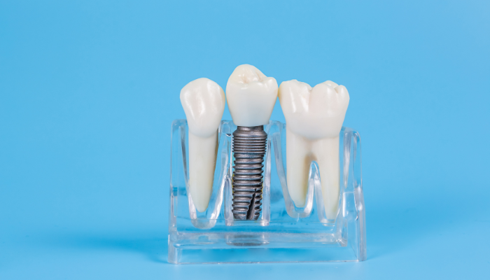 ABQ Gentle Dentistry – Dental Implant Specialist in Albuquerque, NM 87111