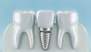 Rankin and Mingle Dentistry - Dental Implant Specialist in Aurora, CO 80016