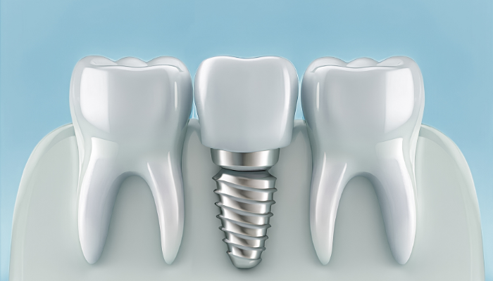 Rankin and Mingle Dentistry - Dental Implant Specialist in Aurora, CO 80016