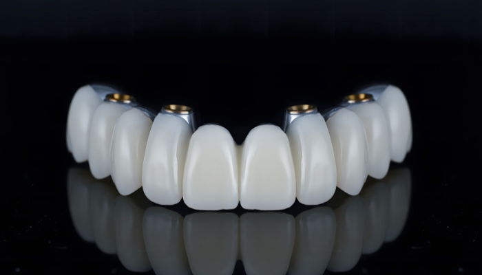 Barrington Smiles - Dental Implant Specialist in Barrington, IL 60010