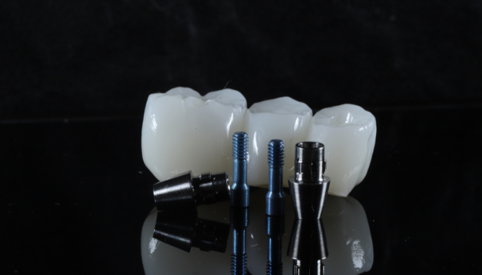 Campbell Dental Arts - Dental Implant Specialist in Escondido, CA 92025