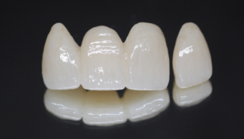 Paso Robles Dental Care - Restorative Dentist in Paso Robles, CA 93446