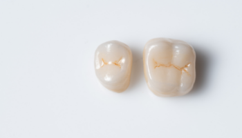 Dublin Family Dental - Restorative Dentist in Dublin, CA 94568