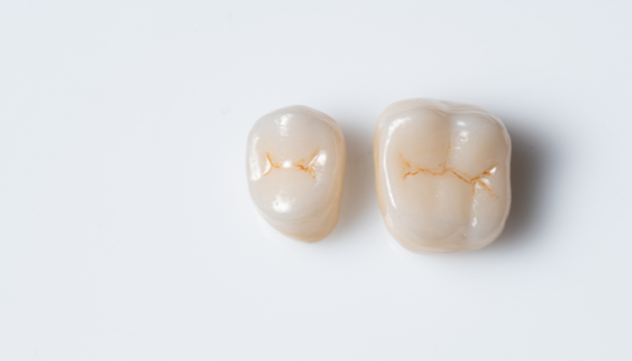 Dublin Family Dental - Restorative Dentist in Dublin, CA 94568