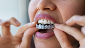 Florida Dental Studio - Clear Aligners in Pompano Beach, FL 33062