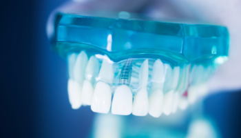 Kayscreek Dental - Dental Implant Specialist in Kaysville, UT 84037