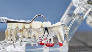 Nautical Dental - Endodontics in San Antonio, TX 78247