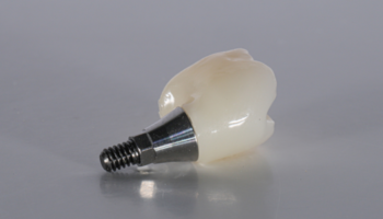 Summer Creek Dental - Dental Implant Specialist in Humble, TX 77396