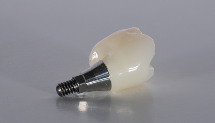 Summer Creek Dental - Dental Implant Specialist in Humble, TX 77396
