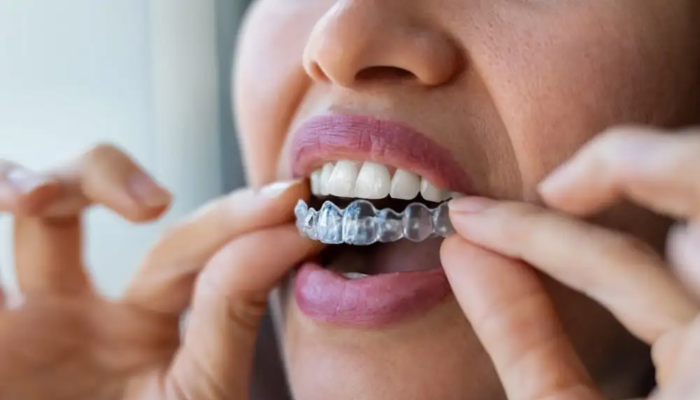 Free State Dental - Clear Aligners in De Soto, KS 66018