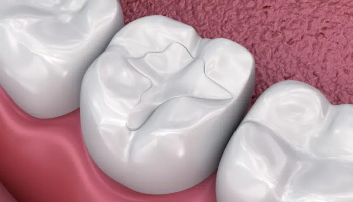 Preston Commons Dental Care - Restorative Dentist in Dallas, TX 75225