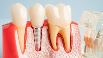 Key Dental - Dental Implant Specialist in Brownsville, TX 78521