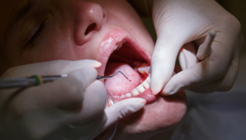 dental exam 78247 Ryan Beyea, DDS - Periodontist in Okemos, MI 48864