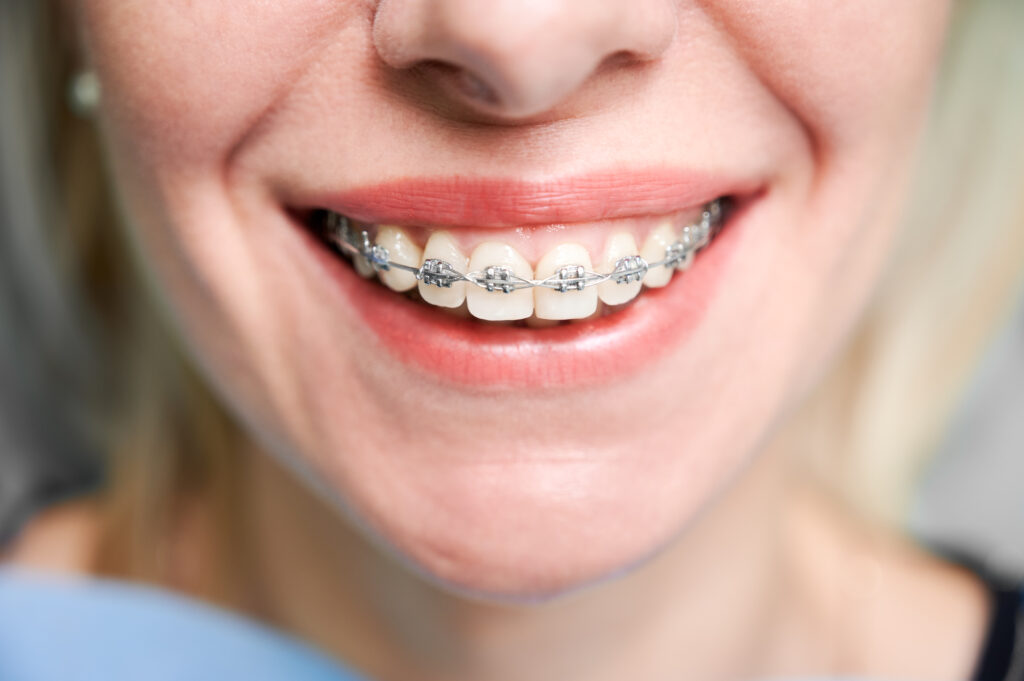 Keyser Orthodontics - Orthodontist in Raleigh, NC 27608