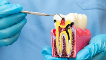 Smiles of Groton - Endodontist in Groton, MA 01450