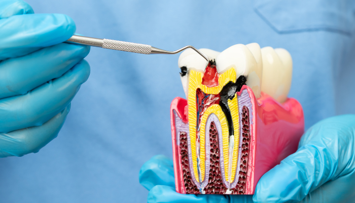 Smiles of Groton - Endodontist in Groton, MA 01450