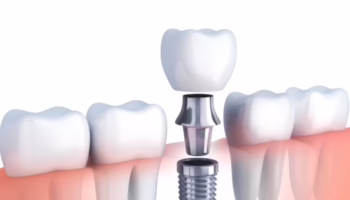 Bruggeman Dental - Restorative Dentist in Thornton, CO 80023