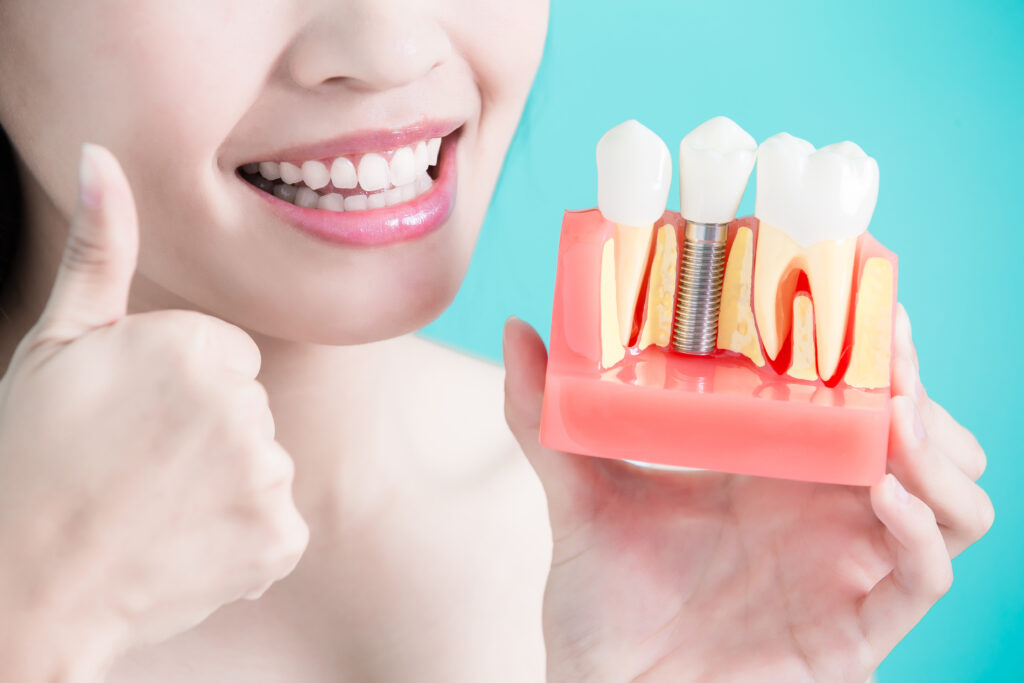 Cardwell Dental Care - Dental Implant Specialist in Honolulu, HI 96826