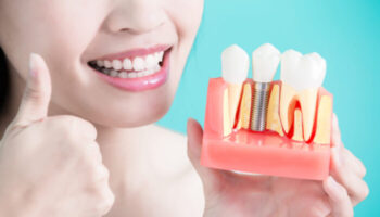 Cardwell Dental Care - Dental Implant Specialist in Honolulu, HI 96826