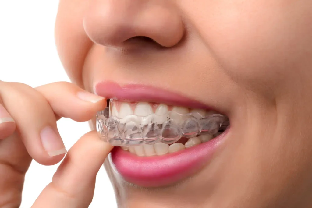 Cardwell Dental Care - Clear Aligners in Honolulu, HI 96826