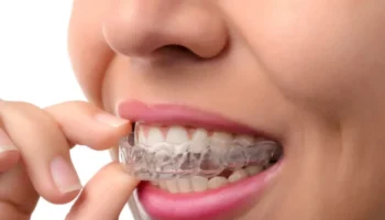 Cardwell Dental Care - Clear Aligners in Honolulu, HI 96826