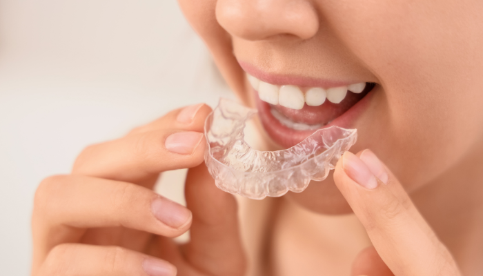 Elevate Dental - Clear Aligners in Las Vegas, NV 89178